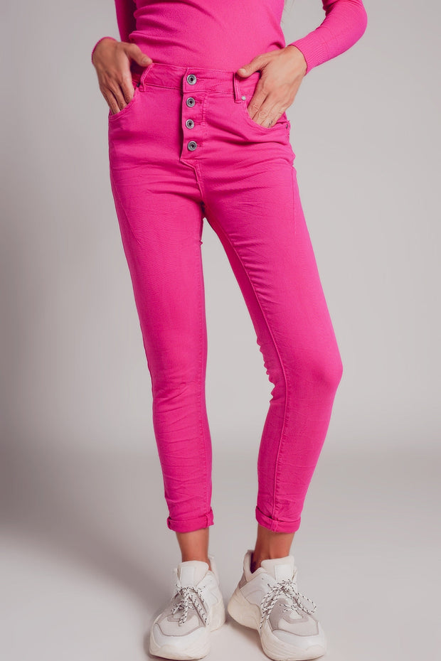 Exposed Buttons Skinny Jeans in Fuchsia